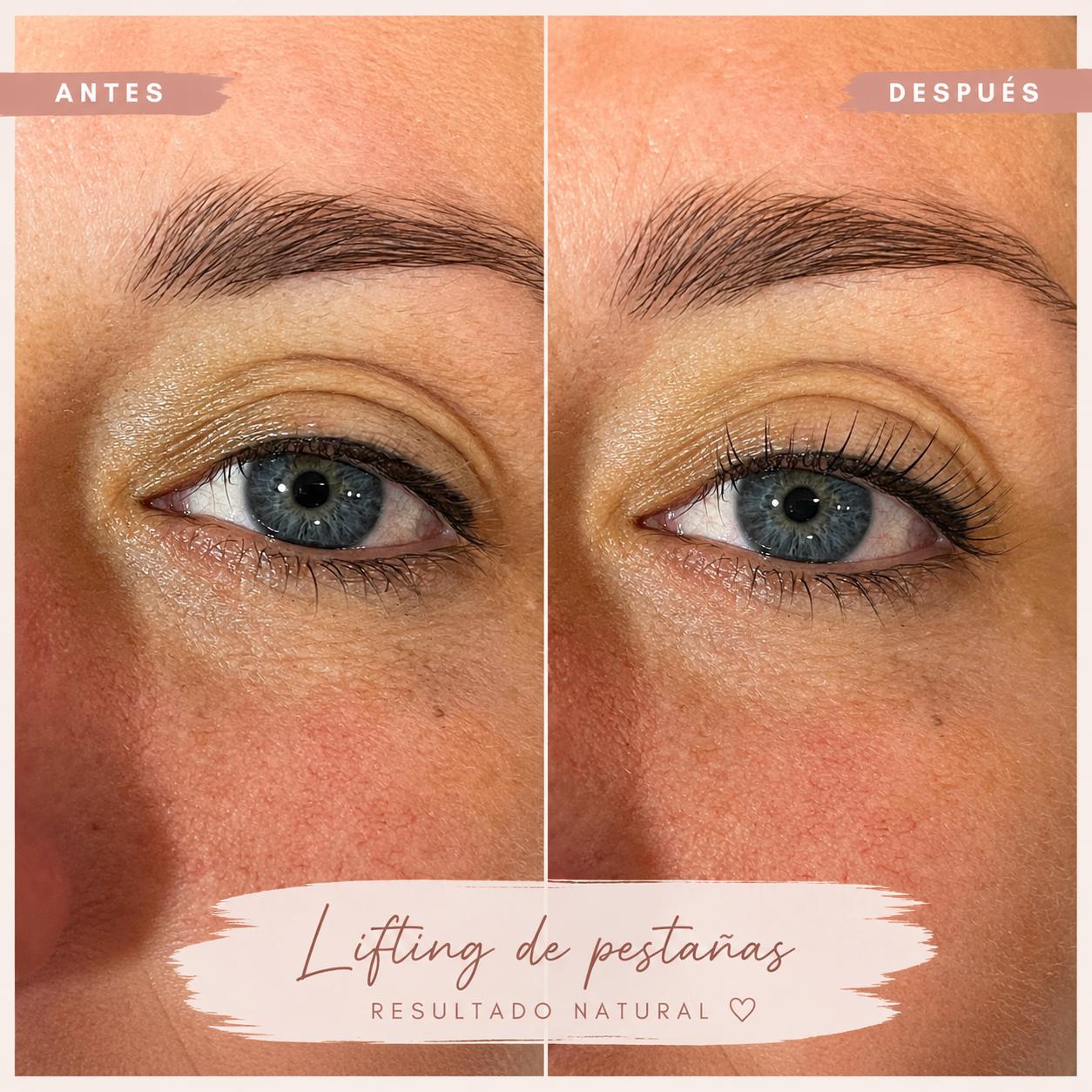 Lifting de pestañas: antes y después, resultado natural