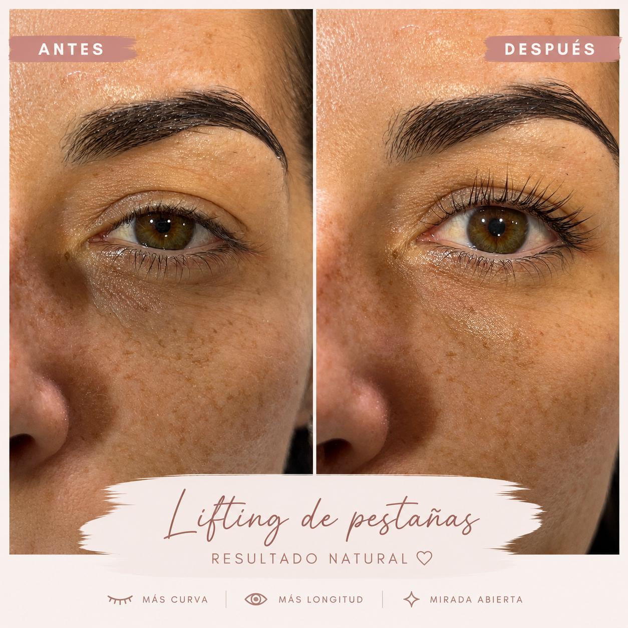 Lifting de pestañas con más curva y longitud: antes y después