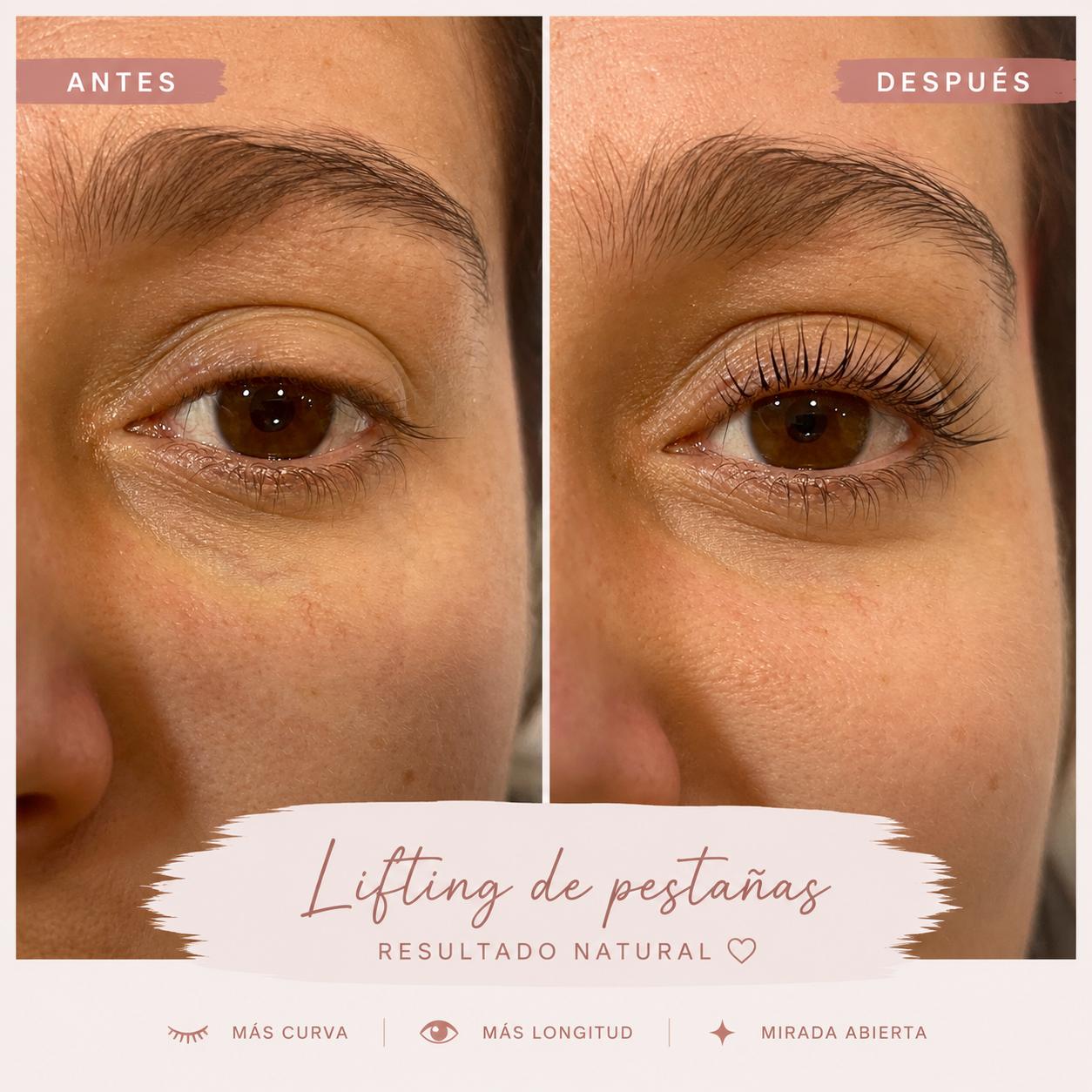Lifting de pestañas con mirada más abierta: antes y después